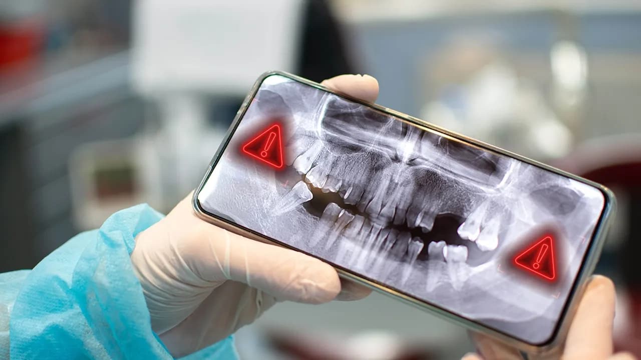 Lying Through Their Teeth: Westend Dental Fined $350K for Ransomware Cover-Up